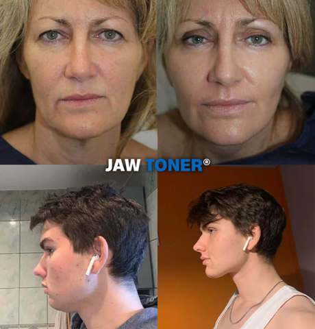 Riarye Jaw Toner - Advanced Facial Exerciser
