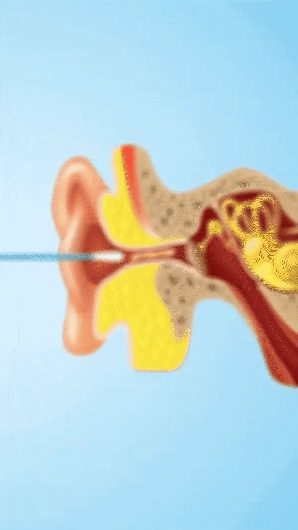 Hilipert Visual Ear Cleaner