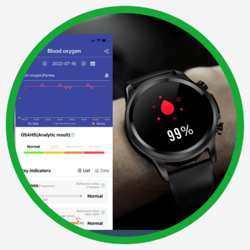 Diabetes Smartwatch