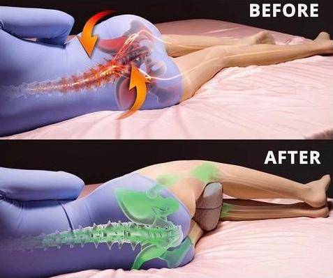 smoothspine alignment pillow relieve hip pain sciatica 1